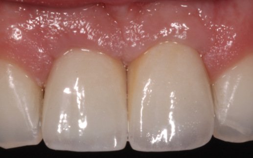After treatment: case 1 of 22
