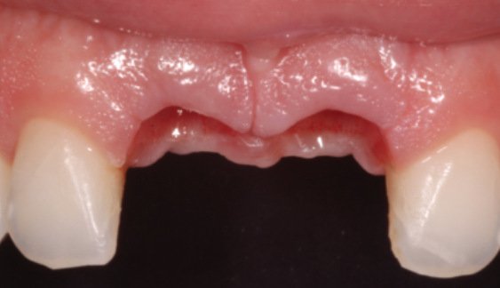 Before treatment: case 1 of 22